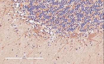 BDH2 Antibody