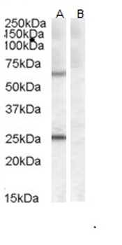 ATP13A1 Antibody