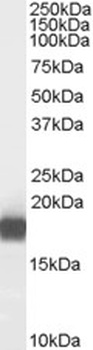 Arylsulfatase A Antibody