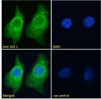 Argininosuccinate Synthetase 1 Antibody