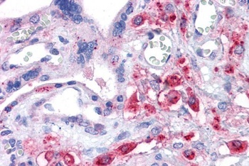 Argininosuccinate Synthetase 1 Antibody