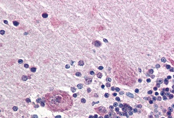 ABCB5 Antibody