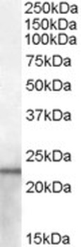 ABCB5 Antibody