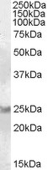 AADACL1 Antibody