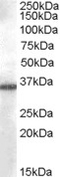 AADACL1 Antibody