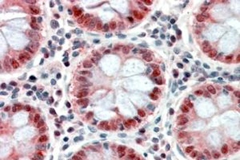 ZNF703 Antibody