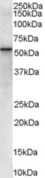 LDB3 Antibody