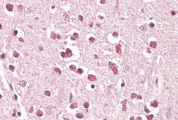 XAB2 Antibody
