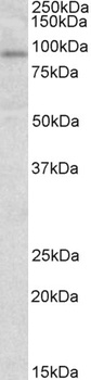 WT1 Antibody