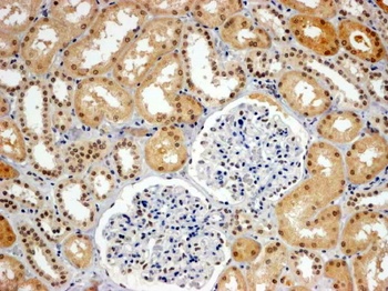 WRNIP1 Antibody
