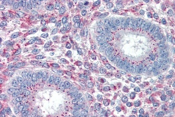 WISP1 Antibody