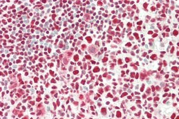 VEGFA Antibody
