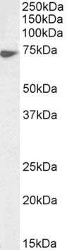Uromodulin Antibody