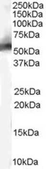 VTI1B Antibody