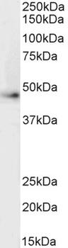 VPS45 Antibody