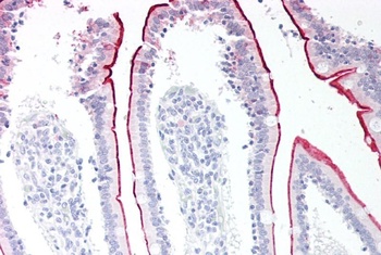 VPS45 Antibody