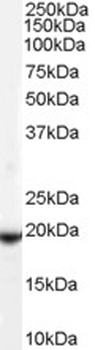 VPS45 Antibody