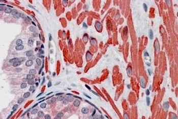 VPS37C Antibody