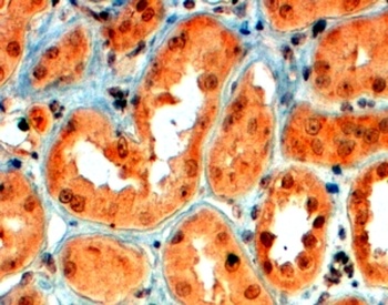 VPS29 Antibody