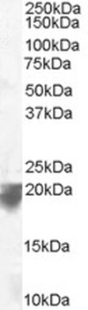 VPS29 Antibody