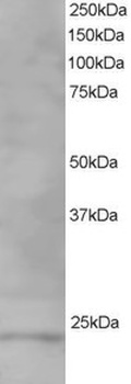 VPS28 Antibody