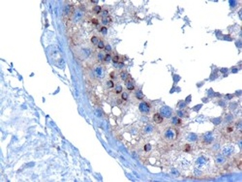 VPS28 Antibody
