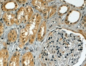 VPS25 Antibody
