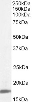 VPS11 Antibody