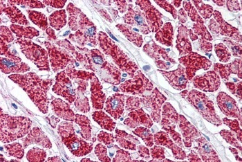 VDAC2 Antibody