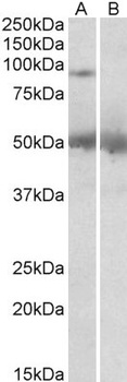 USP6 Antibody