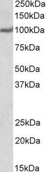 USP4 Antibody