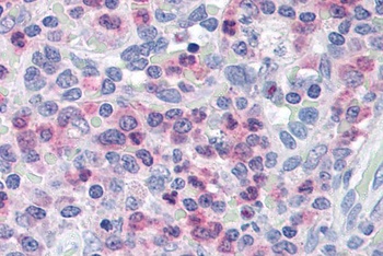 UNC13D Antibody