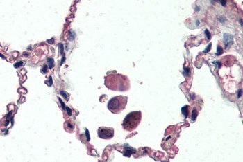 UCP2 Antibody