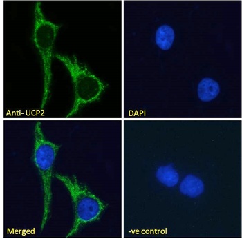 UCP2 Antibody