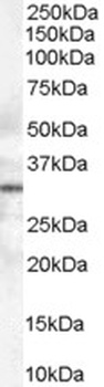 UCP1 Antibody