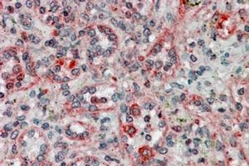 TXNDC1 Antibody