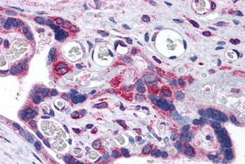 TXNDC1 Antibody