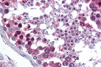 TXNDC1 Antibody