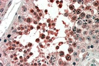 TUSC4 Antibody