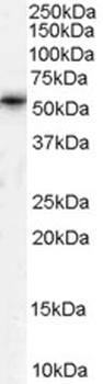 TSPO Antibody