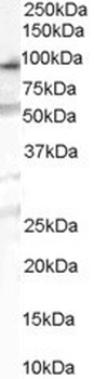 TPH2 Antibody
