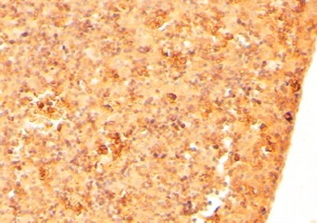 TRPC6 Antibody