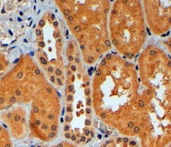 TRIM11 Antibody