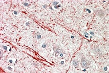 Fgf23 Antibody