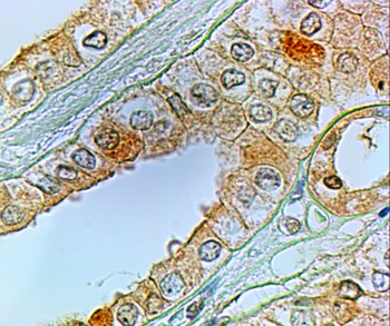 TRAF1 Antibody