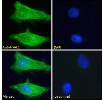 TPD52 Antibody