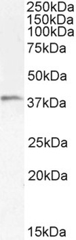 HAVCR2 Antibody