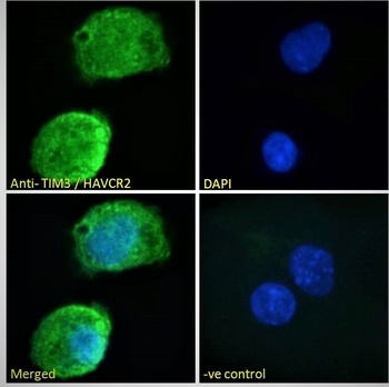 HAVCR2 Antibody