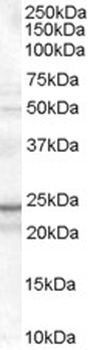HAVCR2 Antibody