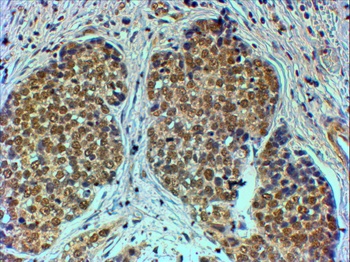TRIM24 Antibody